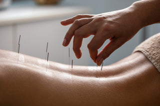 How Acupuncture Can Boost Your Fertility: The Ancient Secret You Need to Know
